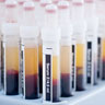 tests sanguins et analyses